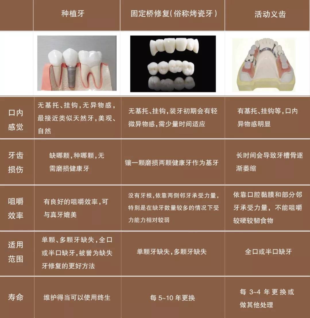 缺牙补牙最新技术，重塑口腔健康的革命性突破